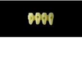 Cod.E12 f LOWER ANTERIOR  :  15x   hollow pontics-blocks  for full coverage, acrylic or porcelain, SMALL, (42-32)